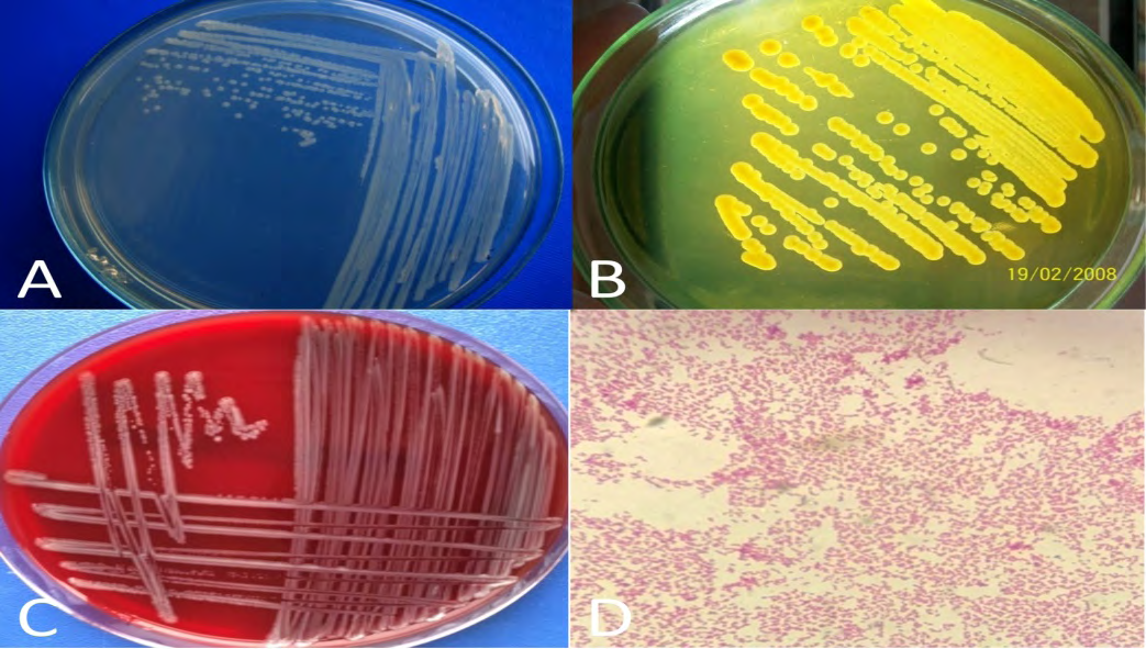 Figure 2: Cream-colored 24-hours pure subculture colonies of L. anguillarum re-isolate on TSA containing 1% NaCl (A), L. anguillarum isolate on TCBS agar (B), L. anguillarum isolate on blood agar (C), a microscopic image of L. anguillarum to gram staining (D) (permission for the pictures were obtained from Prof. Dr. Ertan Emek Onuk and Assoc. Prof. Dr. Secil Metin).