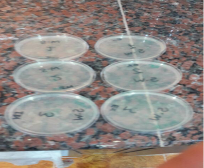 Figure 4: Purification of isolated bacterial strains.