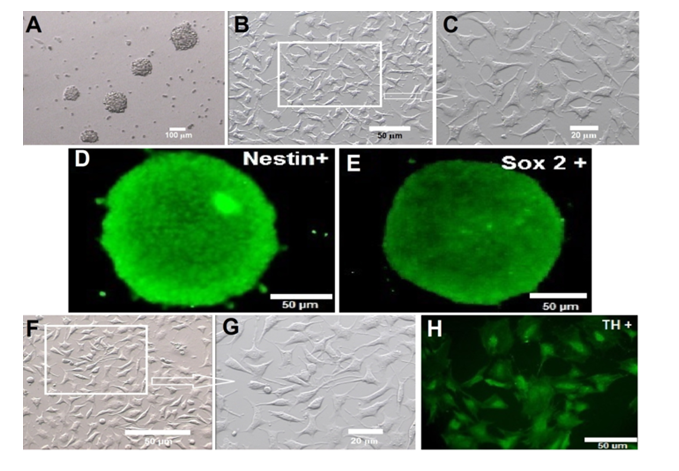 Figure 2: Isolation and culture of Neural Stem Cells. Phase-contrast images of neurospheres (A) and neurons after cell differentiation(B,C). Immunocytochemical analysis of neurosphere with the antibodies against Nestin (D) and Sox- 2(E) markers for neural stem cells. Phase-contrast images of noradrenergic- like cells (F, G) and Tyrosine hydroxylase (TH) positive cells with antibodies against TH (H).