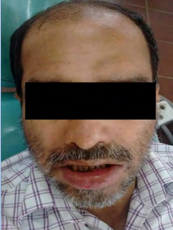 Figure 1: Extraoral photograph.
