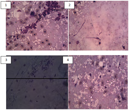 Figure 4: 1,2. Henneguya sp. in liver, 3 Cryptobia spp in the liver and 4 Microsporidia in liver.