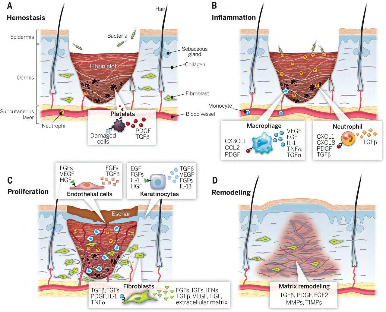 Figure 1: Stages of wound healing. It is classically divided into four stages: (A) hemostasis, (B) inflammation, (C) proliferation, and (D) remodeling. Each stage is characterized by key molecular and cellular events and is coordinated by a host of secreted factors that are recognized and released by the cells as a wounding response. Representative subsets of major factors are depicted. CCL2, chemokine (C-C motif) ligand 2; CX3CL1, chemokine (C-X3-C motif) ligand 1; CXCL1, chemokine (C-X-C motif) ligand 1; CXCL8, C-X-C Motif Chemokine Ligand 8; EGF, Epidermal growth factor; FGF2, basic fibroblast growth factor; FGFs, fibroblast growth factors; HGF, hepatocyte growth factor; IFNs, interferons; IGFs, insulin-like growth factors; IL-1, interleukin-1; IL-1β, interleukin-beta; MMPs, matrix metalloproteinases; PDGF, platelet-derived growth factor; PDGI, platelet- derived growth inhibitor; PGF2, Prostaglandin F2; TGFα, transforming growth factor-alpha; TGFβ, transforming growth factor- beta; TIMPs, tissue inhibitor of metalloproteinases; TNF-α, tumor necrosis factor alpha; VEGF, vascular endothelial growth factor (28).