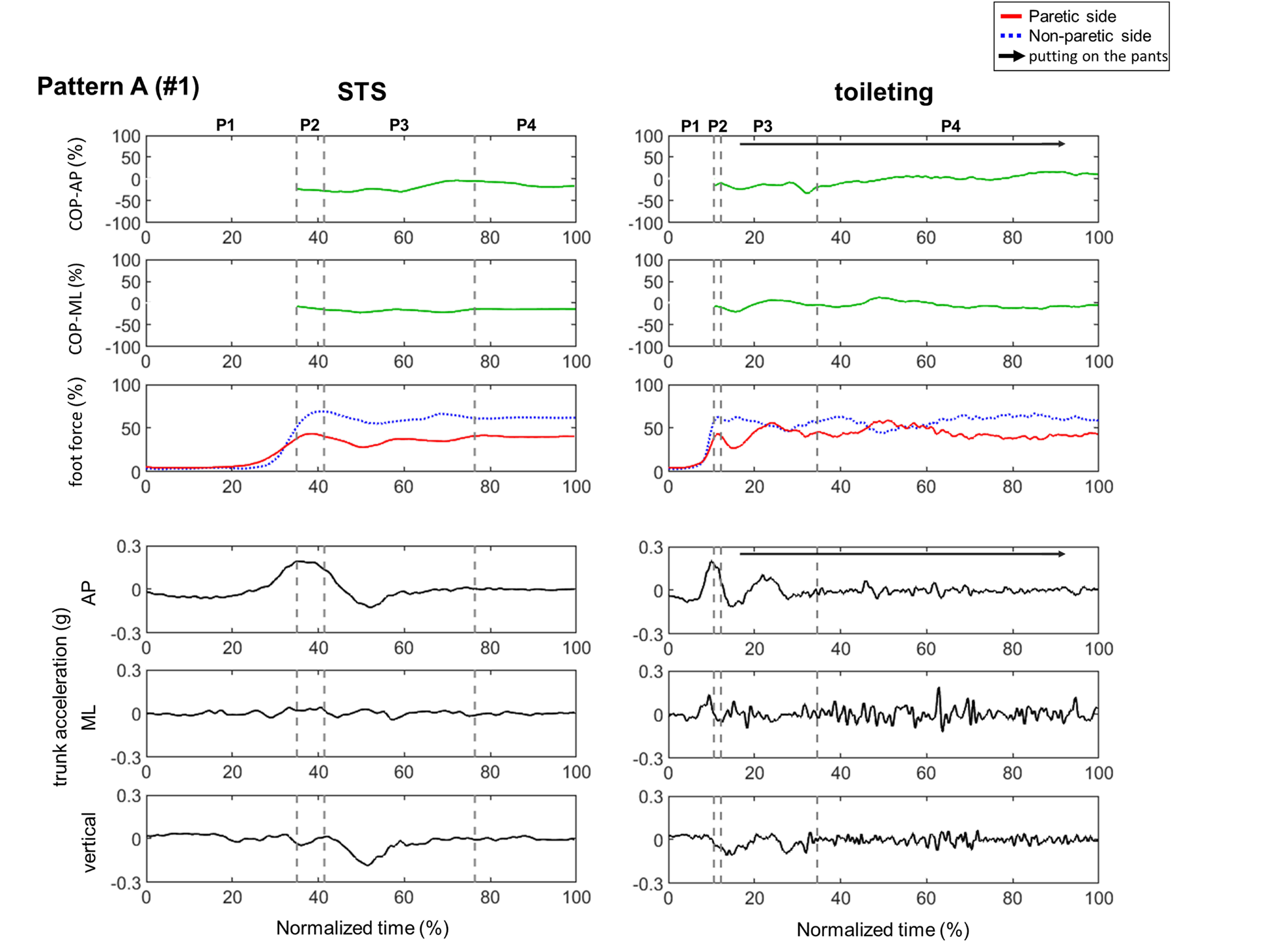 Figure 3: The STS COP-ML remained on the non-paretic side from the start to the end of the motion. However, the COP-ML changed near the center during toileting while the participant pulled up their pants in P3 and P4. At that time, repeated displacement to the paretic side occurred.