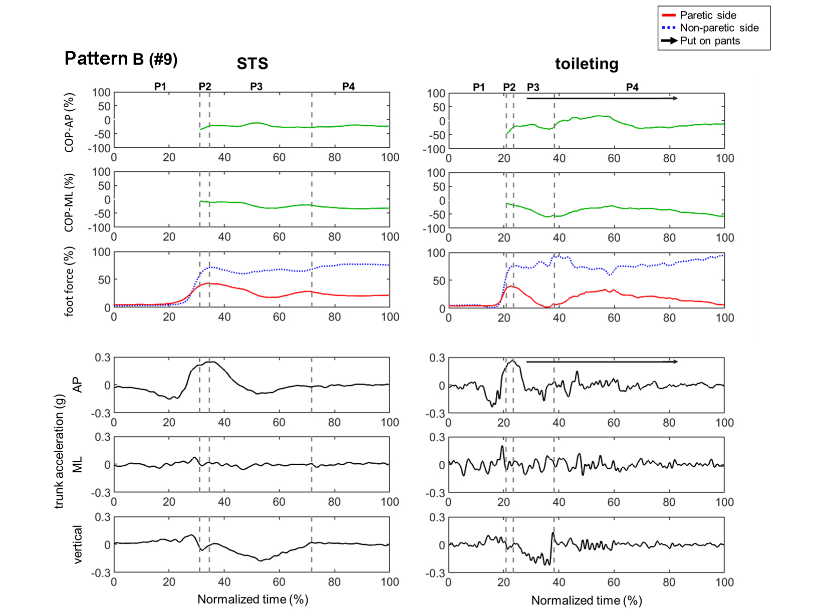Figure 4: The results showed that the STS COP-ML always remained on the non-paretic side from the start to the end of the motion.