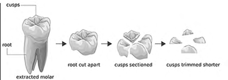 Figure 1: Schematic representation of preparing enamel antagonist [23].