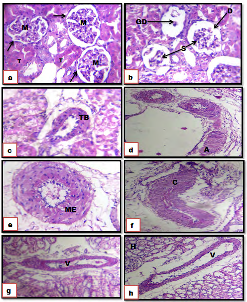 Figure 3: Photomicrograph of sections of the kidney. (a): Control groups showing normal histological structures of Malpighian corpuscles with its glomerulus (M) Bowman’s capsule (arrow), tubules (T). (b-h): Gen showing dilatation of Bowman’s capsule (D), glomerulus shrinkage (S), glomerular degeneration (GD), Thickened blood vessels (TB). Amyloid (A), Metaplasia (ME), Congestion and Compression of blood vessels (C), Vasodilatation of blood vessels (V), Hydropic change (H). (H&E X 100).