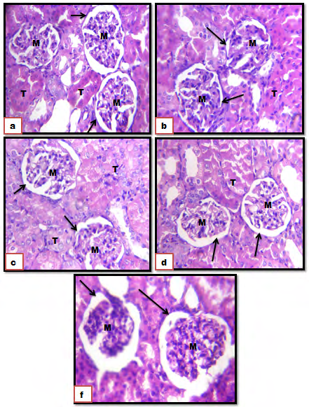 Figure 4: Photomicrograph of sections of the kidney. (a): Control groups showing a normal architecture without pathological alterations. (b): Gen+ Osaimi sider honey (c): Gen + Athel honey; (c): Gen + Dam Al-Akhawain honey; (d): Gen + Salam honey, showing a normal kidney structure as in control group. (f): Malpighian corpuscles with its glomerulus (M) Bowman’s capsule (arrow), tubules (T). (HE) stain (X400).