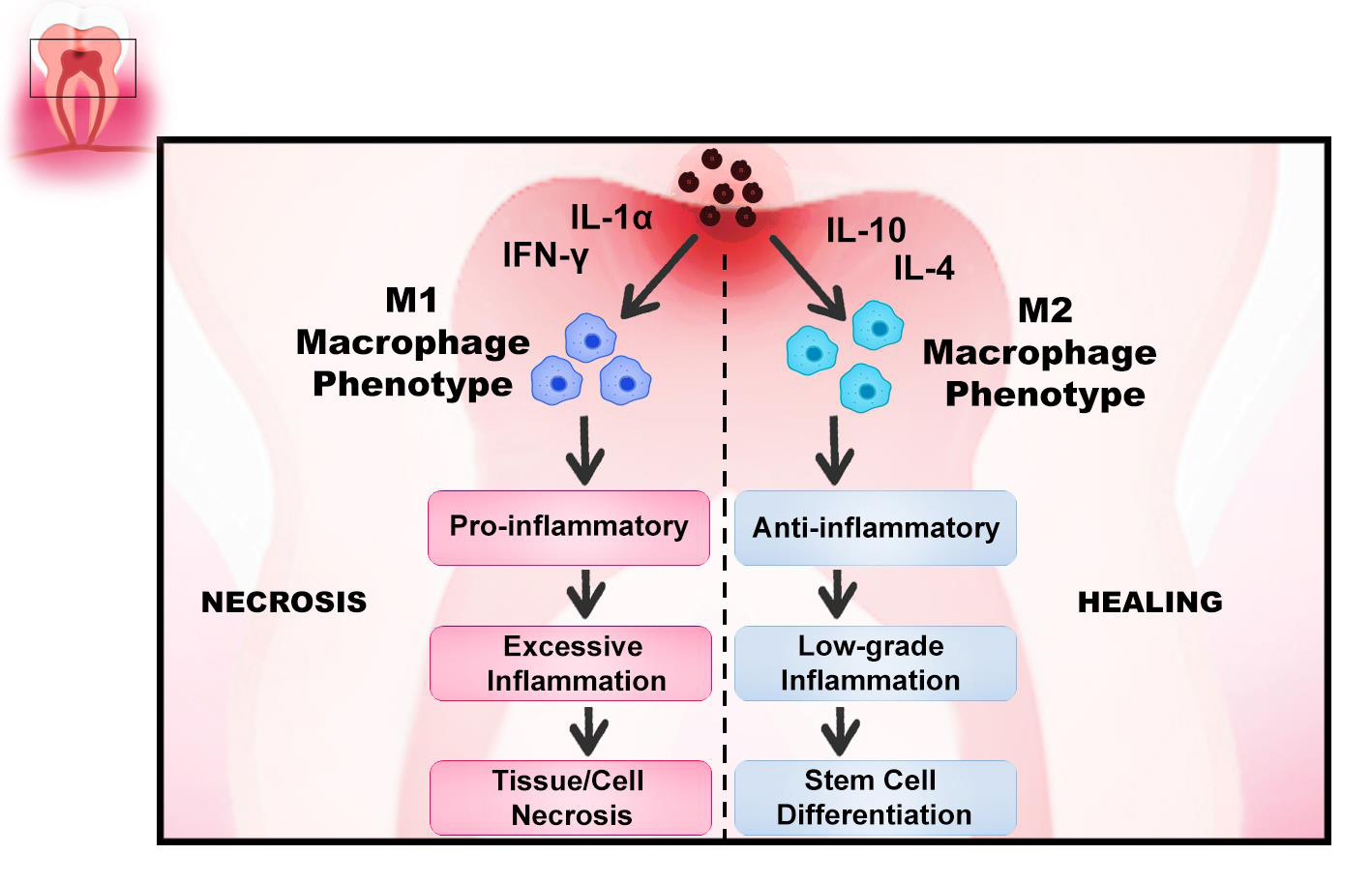 Figure 6: M1-M2 macrophage polarization is one of the key steps in tissue repair as they regulate dental pulp stem cell activation and inflammation.