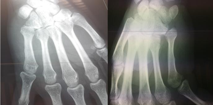 Figure 1: Pre operative imaging.