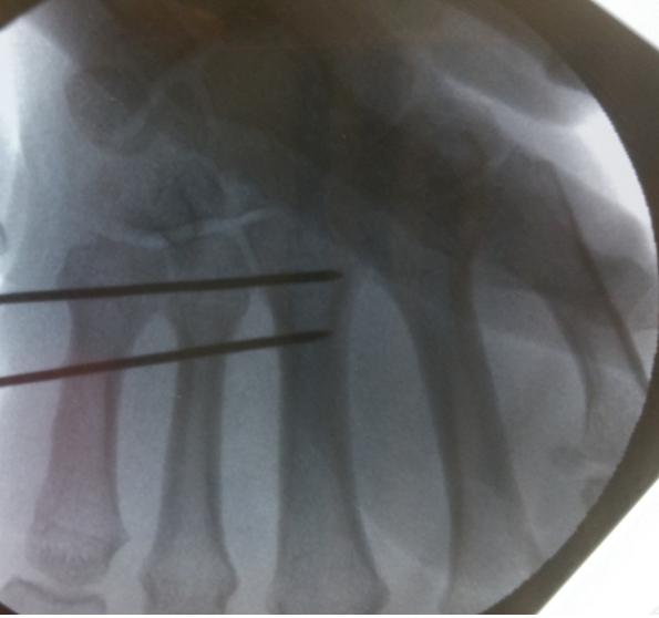 Figure 2: Perioperative imaging.