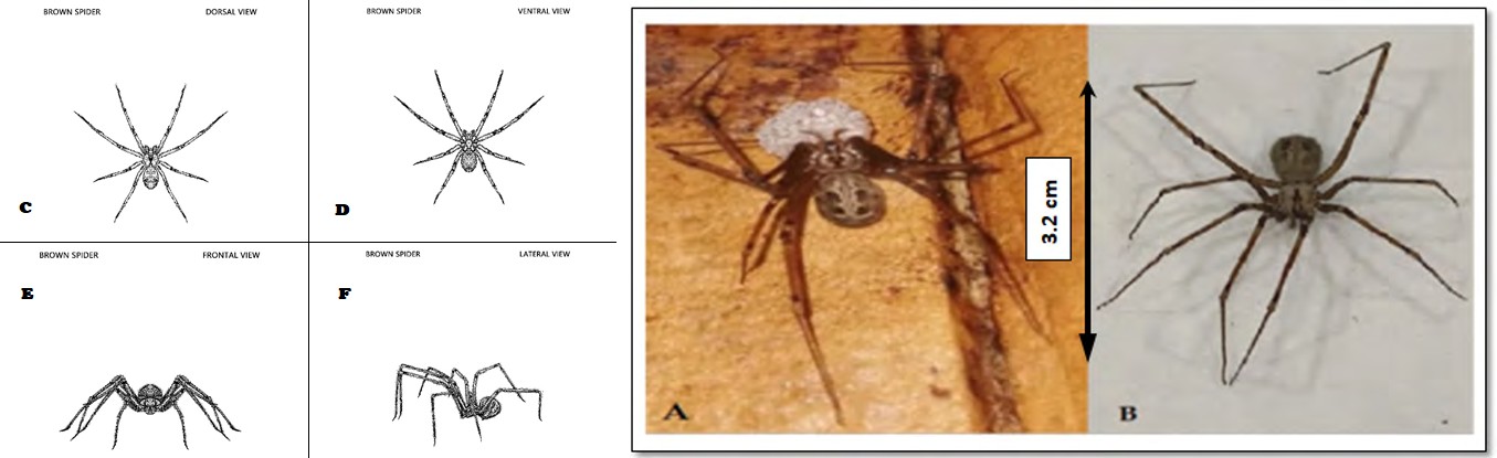 Figure 2: A&B: The Brown widow spider specimen (Latrodectus geometricus) with the egg sac. C,D,E&F Drawings of the dorsal, ventral, frontal and lateral views of the collected specimen.