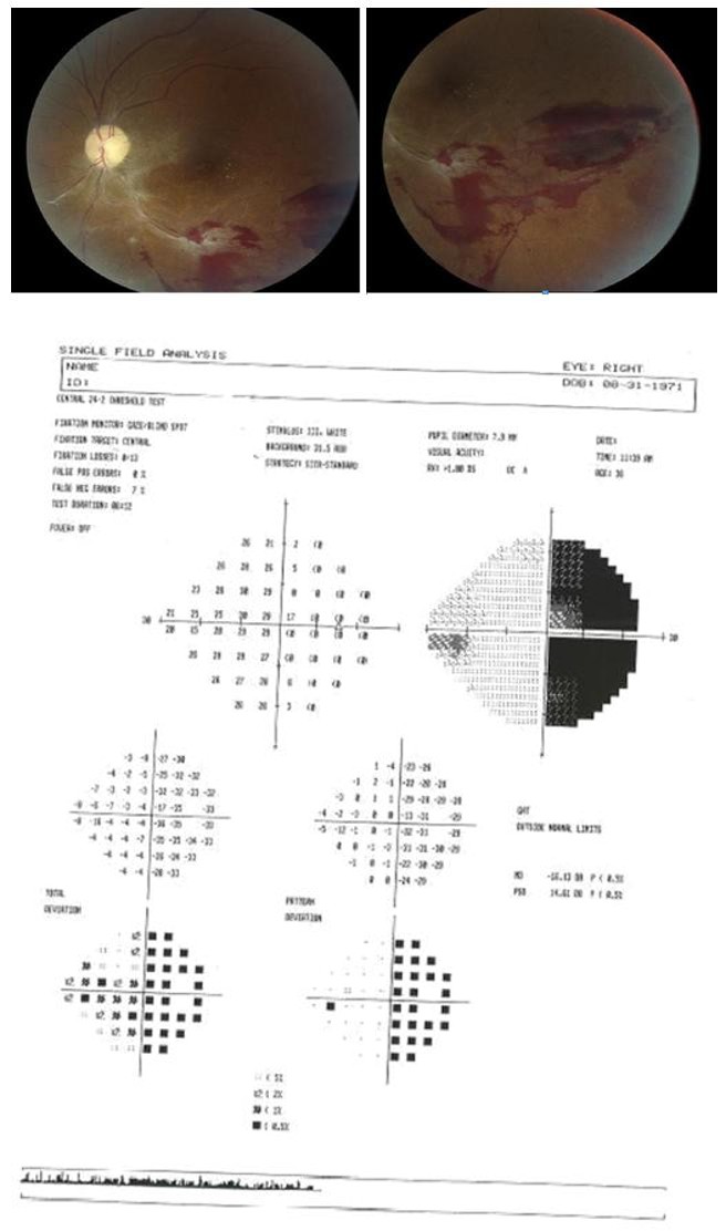 Figure 5: Step in diagnosis.