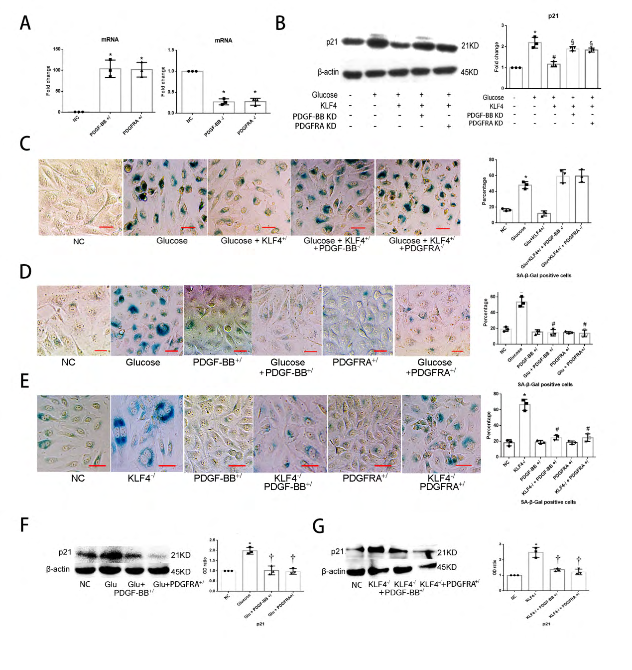 Figure 5: PDGF-BB/PDGFRA regulates ECs senescence: (A) qPCR for PDGF-BB and PDGFRA mRNA to test the efficiency of knock-in and knockdown vectors. Non-specific control HUVECs (NC) transfected with empty vectors were used as a control group. *p<0.05 versus NC. (B) Deficiency of PDGF-BB or PDGFRA increases p21 expression in KLF4+/ ECs. (C) Deficiency of PDGF-BB or PDGFRA increases SA-β-gal positive cells number in KLF4+/ ECs. Green, SA-β-gal positive cells. N=3; *p<0.05 versus NC; Scale bar, 100um. (D) Enrichment of PDGF-BB/PDGFRA decreases SA-β-gal positive cells percentage in glucose-incubated ECs. Green, SA-β-gal positive cells. N=3; *p<0.05 versus NC ECs; #p<0.05 versus glucose-incubated ECs. Scale bar, 100um. (E) Enrichment of PDGF-BB/PDGFRA decreases SA-β-gal positive cells percentage in KLF4-/ ECs. Green, SA-β-gal positive cells. N=3; *p<0.05 versus NC ECs; #p<0.05 versus KLF4-/ ECs. Scale bar, 100um. (F) Enrichment of PDGF-BB/PDGFRA decreases p21 expression in glucose-incubated ECs. N=3; *p<0.05 versus NC ECs; †p<0.05 versus glucose-incubated ECs. (G) Enrichment of PDGF-BB/PDGFRA decreases p21 expression in KLF4-/ ECs. N=3; *p<0.05 versus NC ECs; †p<0.05 versus KLF4-/ ECs. ECs, endothelial cells; Glu, glucose; NC, non-specific control; KLF4+/, KLF4 knock-in; KLF4-/, KLF4 knock-down; PDGF-BB-/, PDGF-BB knock-down; PDGFRA-/, PDGFRA knock-down; PDGF-BB+/, PDGF-BB enrichment; PDGFRA+/, PDGFRA enrichment.