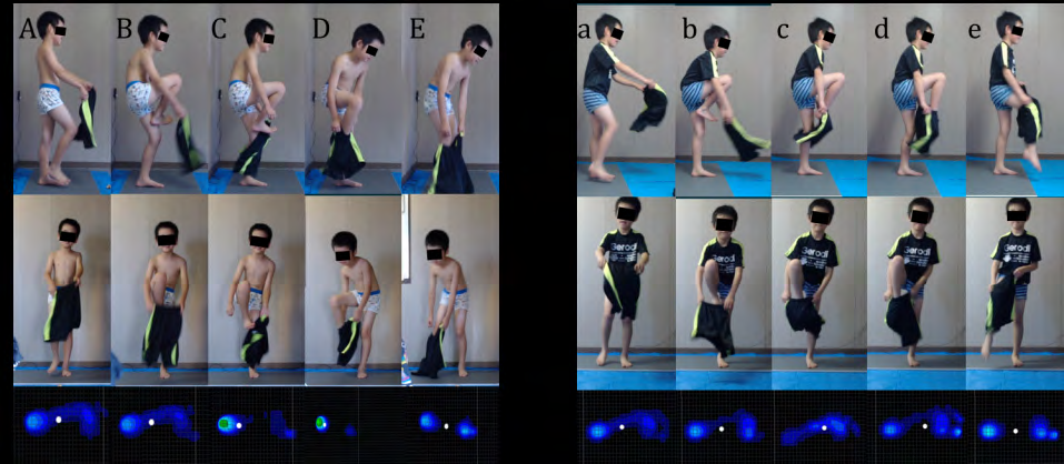 Figure 6: Photographic playback of the trouser-wearing motion of participant 2 after the first and fourth OT interventions.
