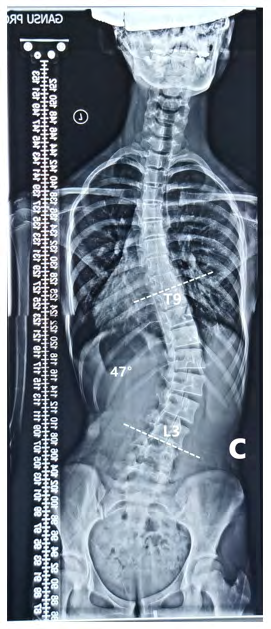 Figure 4: After treatment.
