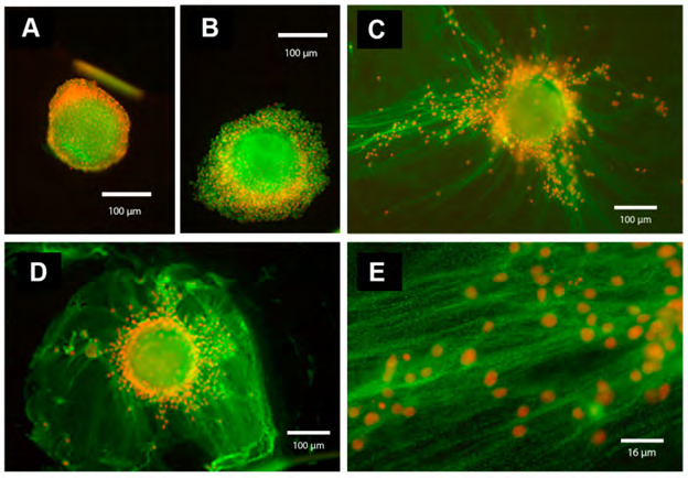 Figure 4: Courtesy ref no-67-Immunofluorescence analysis of IαI components in the oocyte–cumulus ECM.