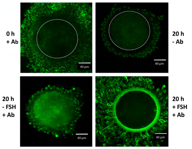 Figure 5: Courtesy ref no-67-Confocal microscope analysis of IαI in the oocyte-cumulus complexes. Oocyte–cumulus cells complexes were analyzed at the beginning (0 h) and at the end (20 h) of the culture carried out in the presence of 5 % FBS, with or without FSH (100 ng/mL) stimulation, as indicated. Immuno reactivity for IαI components was evident in the ECM structure organized around the cumulus cells after FSH stimulation by using a rabbit anti-human IαI antibody (Ab dilution 1:100; DAKO, Carpenteria, CA, USA) and Alexa Fluor 488 goat anti-rabbit IgG as a secondary antibody (dilution 1:500; Molecular Probes, green). The boundary of the oocyte is marked by a dashed line.
