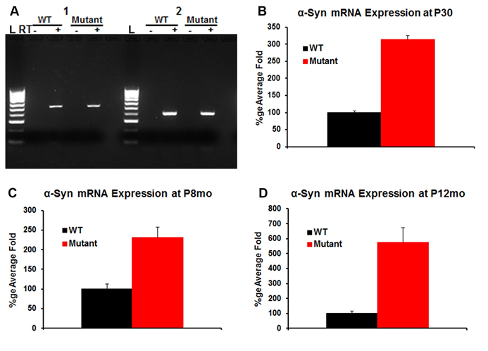 Figure 1: α-Syn mRNA in the WT and transgenic (mutant) cochlea: RT-PCR experiment was used to detect the presence of α-Syn mRNA in the WT and transgenic cochlea using two different set of primers 1 and 2 (Figure 1A). Controls lacking reverse-transcriptase (denoted with a ‘-‘) are included. The data demonstrate expression of α-Syn mRNA in the WT and transgenic cochlea (Figure 1A). Quantitative, real-time PCR was used to determine relative levels of α-Syn mRNA within the cochlea in the WT and the transgenic mice at P30, P8mo and P12mo. The expression levels were compared to the ribosomal protein L19 used as a house keeping gene. α-Syn mRNA shows ~3x amplification in the transgenic cochlea compared to WT at P30 (Figure 1B). α-Syn expression slightly decreased at P8mo (Figure 1C) then increase to reach ~5x amplification in the transgenic at P12mo (Figure 1D) when compared to the WT. Differences between the levels of α-Syn mRNA were statistically significant (n=5) for each sample, p<0.05.