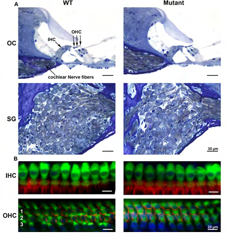Figure 5: Light microscopy of the WT and transgenic (mutant) mice inner ear demonstrates no significant histological differences. Toluidine blue stain of the organ of Corti (OC) and spiral ganglion (SG) region from mid-turn of the WT and transgenic cochlea at P30 shows normal OC morphology and SG cell count (Figure 5A). Figure 5B shows cochlear whole-mount immunofluorescent staining using anti-myosin 7a antibody and rhodamine phalloidin staining. There is no significant difference between WT and transgenic hair cells at P30. Hair cell counts using representative samples of surface preparations show a normal complement of IHC and OHC and no IHC or OHC loss at all locations along the cochlea. Scale bar, 20µm. OHC rows 1–3 are indicated by 1, 2, and 3, respectively.