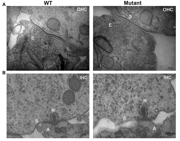 Figure 6: Transmission electron micrographs of medial olivocochlear (MOC) efferent synapses (Figure 6A) demonstrate that general appearance of MOC presynaptic efferent nerve terminals of the WT and transgenic (mutant) mice are normal with normal vesicles with any significant differences in vesicle shape or significant changes of the vesicle pool in the transgenic. We also noted normal IHCs ribbon synapse in the transgenic when compared to WT littermates. Transgenic’s IHC ribbon synapses showed normal appearing shape similar to the WT with no significant increase of vesicles pool (Figure 6B). OHCs efferent terminal labeled (E); synaptic membrane (S); Outer hair cells (OHC); Inner hair cells (IHC); afferent terminals (A); IHC ribbon synapse (R).