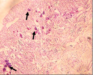 Figure 17