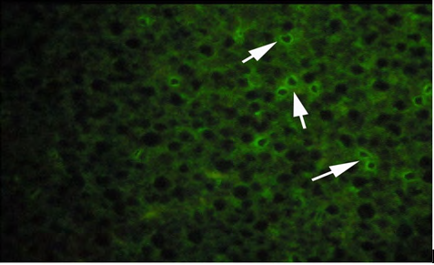 Figure 7: Dot blot test showing the efficiency of the Western blot procedure and the binding of the primary antibody to Vtg standards. The standards were (16.67, 8.3, 4.2, 2.1, 1.0, 0.5 and 0.26ng/PBSµl). The dot appeared only in the first 4 VTG standard concentrations (red circle).