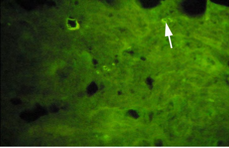 Figure 8: ** Light micrograph of high-dose exposed fish group.