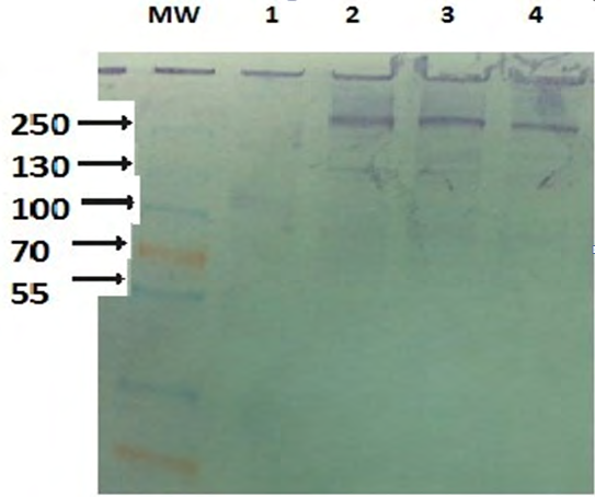 Figure 9: Hepatosomatic index of sea bream exposed to EE2 for two weeks.