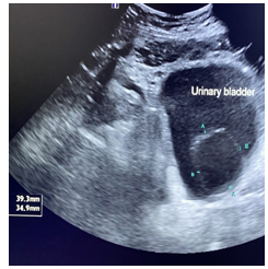 Figure 2: a: Before resection of ureterocele, b: After partial resection.