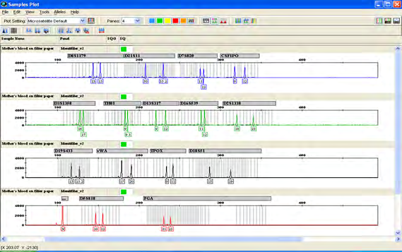 Figure 13: Electropherogram of Case study 2-Exhibit A.