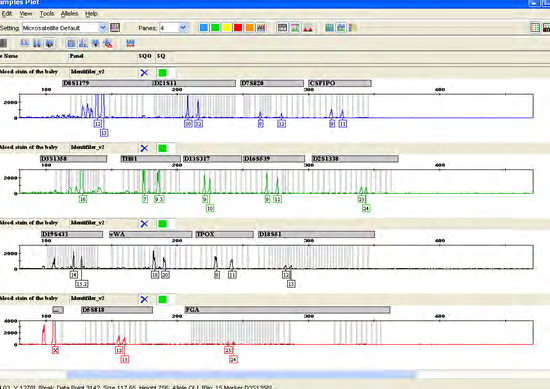 Figure 15: Electropherogram of Case study 2-Exhibit C.
