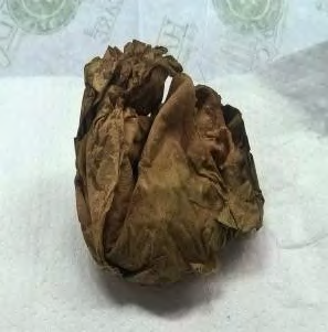 Figure 2: Case 1_Exhibit B_Dried umbilical cord of deceased baby.