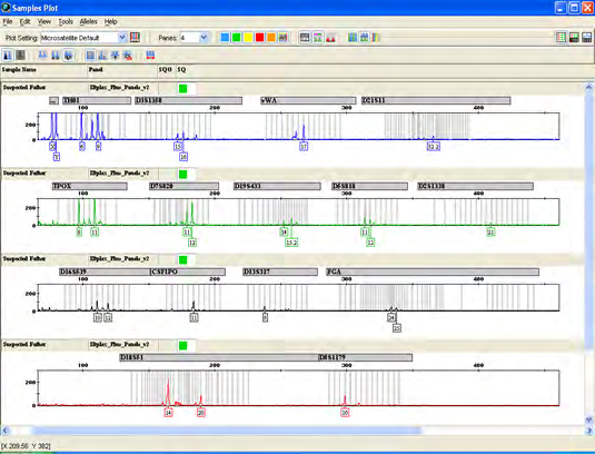 Figure 9: Electropherogram of Case study 1-Exhibit A