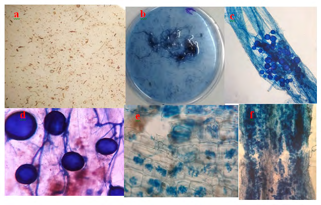 Figure 15: a. Consortium AM fungal spores b. AM fungi root colonization staining; c. Vesicles and mycelium formation; d. Mature vesicles and mycelium; e. Arbuscules and intra and extracellular hyphae; f. Vesicle, arbuscles, and mycelium.