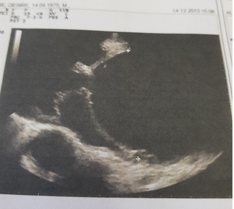 Figure 1: US Scan of heart.