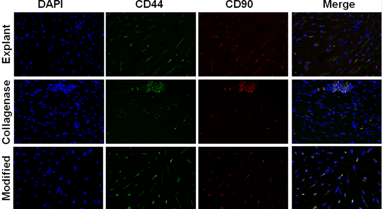 Figure 3: Isolated PMSCs from the explant, collagenase and modified method techniques characterization by immunofluorescence staining of FITC tagged (green) CD44 and TR tagged (red) CD90 markers with counterstaining by DAPI (blue).