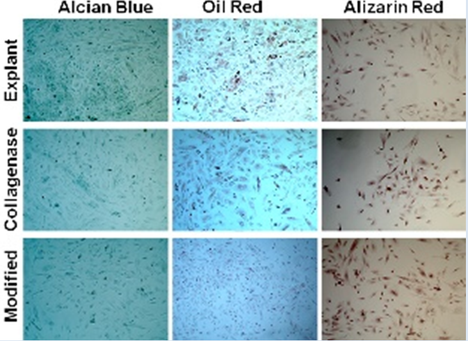 Figure 4: Multilineage differentiation capacity of isolated PMSCs from explant, collagenase and modified method by Alcian blue, Oil red and Alizarin red staining.