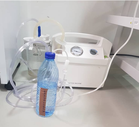 Figure 5: Infusion-giving set connected to our improvised underwater seal which was a 750ml water bottle; the tubing was inserted 2cm below the water line and bubbling with 2 tight holes in the plastic cap, an inlet(infusion set), and outlet. Bottle was kept upright on the floor, then another tubing (outlet) was connected suction machine at about -7.5cmH20 to complete the circuit.