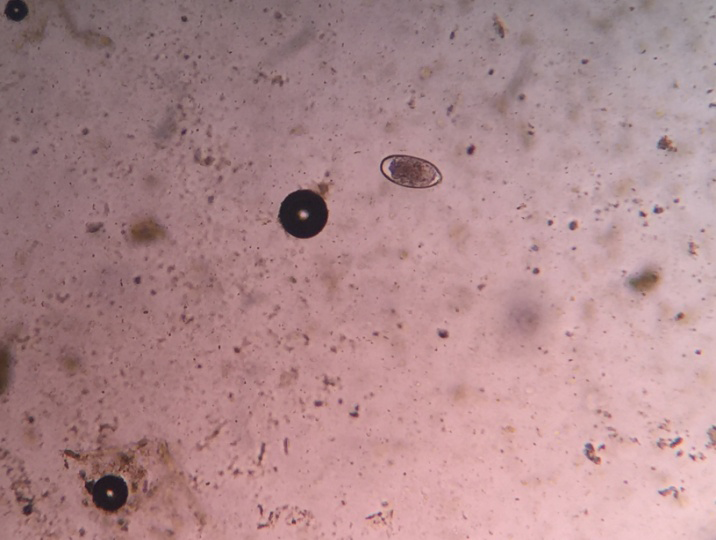 Figure 1: Photomicrograph of Strongyle spp. egg from Black buck.