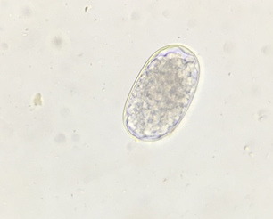 Figure 3: Photomicrograph of Strongyle spp. egg from Sambar deer.