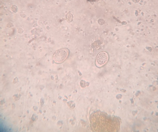 Figure 4: Photomicrograph of Isospora spp. oocyst From Monkeys.