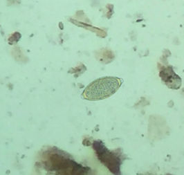 Figure 5: Photomicrograph of Trichuris spp. egg from Tigress.