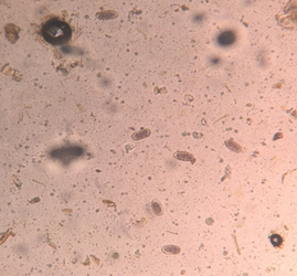 Figure 6: Photomicrograph of Strongyle spp. egg from Nilgai.