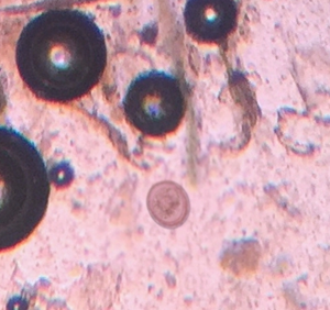 Figure 7: Photomicrograph of Toxoascaris leonina egg from Male Leopard.