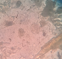 Figure 8: Photomicrograph of Entoamoeba spp. cyst from Monkey.