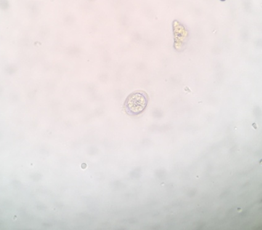 Figure 9: Photomicrograph of Eimeria spp. oocyst from Indian peafowl.