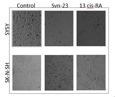 Figure 2: SH-SY5Y and SK-N-SH neuroblastoma cells were treated with 10 µM of SVN-23 oligonucleotides and 13-cis-RA for 5 days. SK-N-SH neuroblastoma cells became flattening (Lower-middle) and SH-SY5Y cells extended their neurites (Upper- middle), both of which represented the neuronal differentiation. 13-cis Retinoic Acid (right panel), a known differentiating agent was used as a positive control.