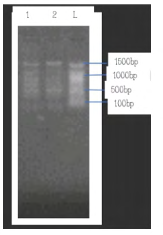 Figure 1: Agarose gel electrophoresis showing the RAPD – PCR Bands of _Bacillus subtilis_.