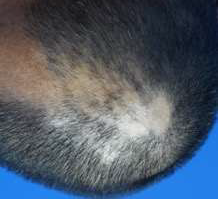 Figure 5: 4th triamcinolone injection treatment (17/11/2021), with 10 mg of Prednisone for 2 weeks