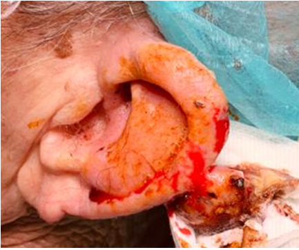 Figure 1: Ear.
